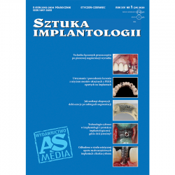 Sztuka Implantologii - wydanie elektroniczne